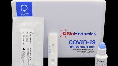 Photo of U SAD-u razvijen uređaj koji testira na koronavirus za pet minuta