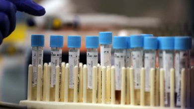 Photo of Crna Gora: Pet novih slučajeva koronavirusa, ukupno 262 zaražene osobe