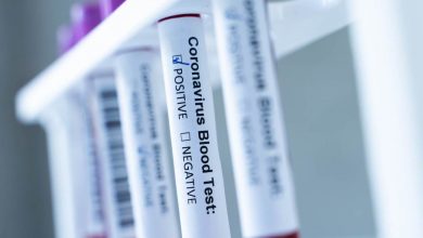 Photo of Svjetska zdravstvena organizacija protiv “pasoša o vakcinaciji”