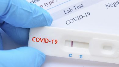 Photo of Osigurano 8000 antigen testova za Domove zdravlja