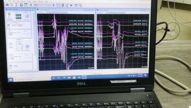 Photo of Opća bolnica – Urađena operacija skolioze uz pomoć novog uređaja za neuromonitoring