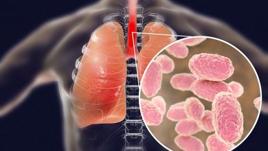 Photo of U Beogradu četvero djece umrlo od velikog kašlja