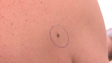 Photo of U subotu besplatni pregledi mladeža za žene oboljele od karcinoma dojke i ginekoloških karcinoma
