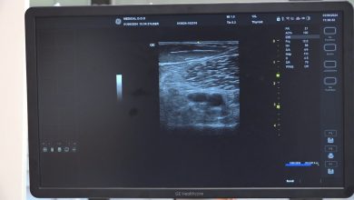 Photo of Hitna pomoć KS bogatija sa novim ultrazvučnim aparatom