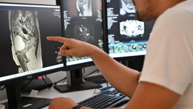 Photo of Inovativna metoda u oblasti urologije: ASA Bolnica donosi revolucionaran pristup u ranom otkrivanju raka prostate 