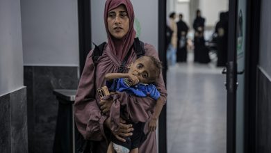 Photo of Fotografija jednoipogodišnjeg Mohammada razotkriva izraelsku politiku izgladnjivanja