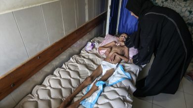 Photo of Glad hara Gazom, najteže pogođeni mališani