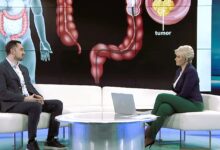 Photo of Dr Selimagić za TVSA: Rak debelog crijeva je izlječiv ako se otkrije na vrijeme