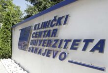 Photo of KCUS – Dozvoljene posjete hospitaliziranim pacijentima